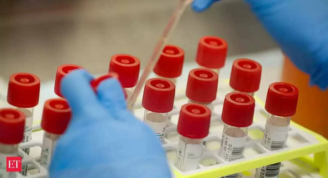 Three lakh more Rapid Antibody Test kits sent to India from China: Envoy