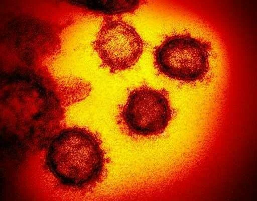 U.S. OKs 1st coronavirus test that allows self-swab at home