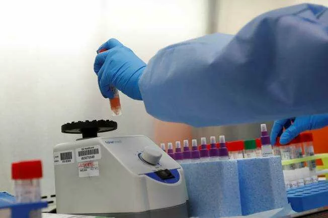 Why RT-PCR COVID-19 test can be cheaper than the Rs 4,500 ICMR price cap